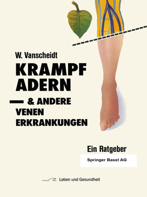 cover image of Krampfadern und andere Venenerkrankungen